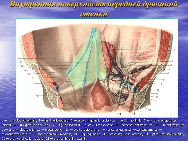 Внутренняя поверхность передней брюшной стенки 1 — m. rectus abdominis; 2 — lig. interfoveolare;